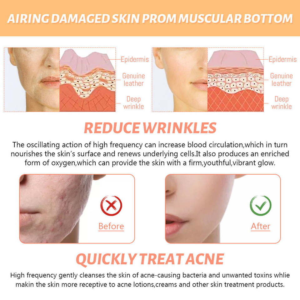 4-in-1 High Frequency Facial Therapy Wand 2.0